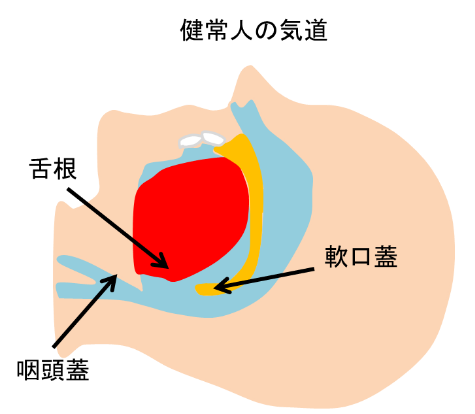 健常人の気道